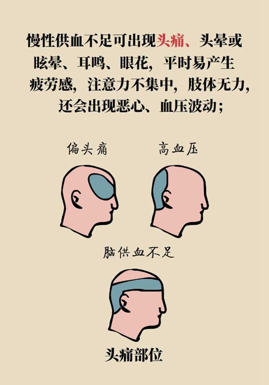 警惕四个诱因会引起脑供血不足